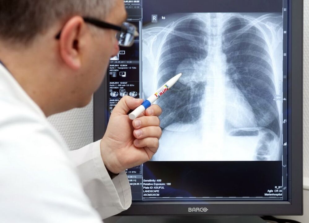 arteriyel hipertansiyon tanısı